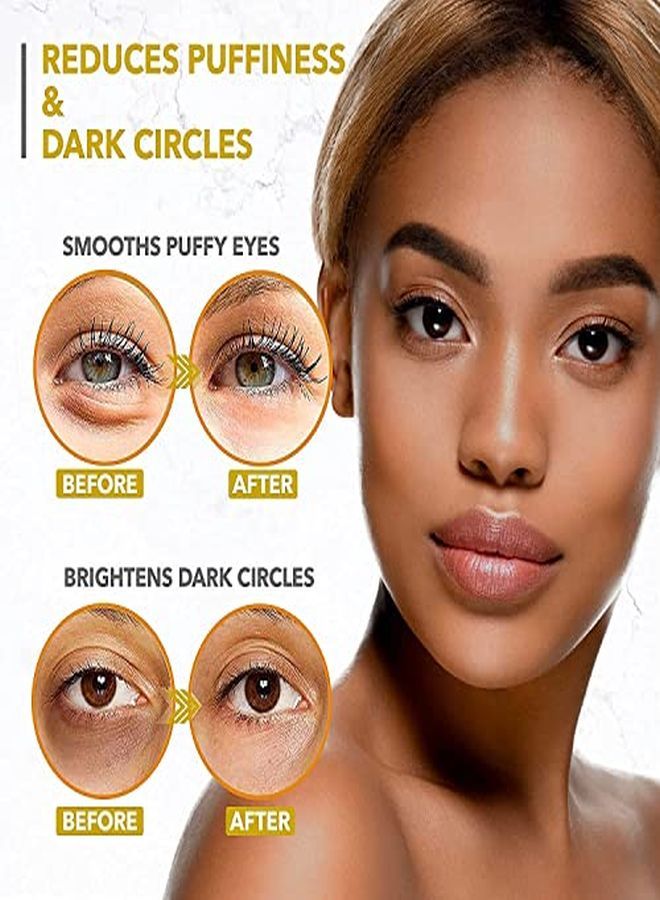 Eye Patches - 24K Gold Under Eye Mask For Puffy Eyes, Dark Circles, Eye Bags, Wrinkles, Puffiness With Collagen - Anti Aging Skincare Eye Patch Treatment Masks - Hydrating Under Eye Gel Pads