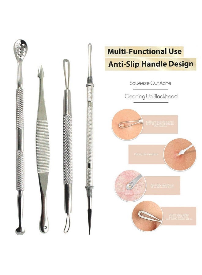 Blackhead Remover Pimple Popper Tools (4 Pc Set) Krisp Beauty Acne Comedone Zit Extractor Remover Kit For Nose Facial Pore Face Blemish Whitehead Popping Extraction Stainless Steel