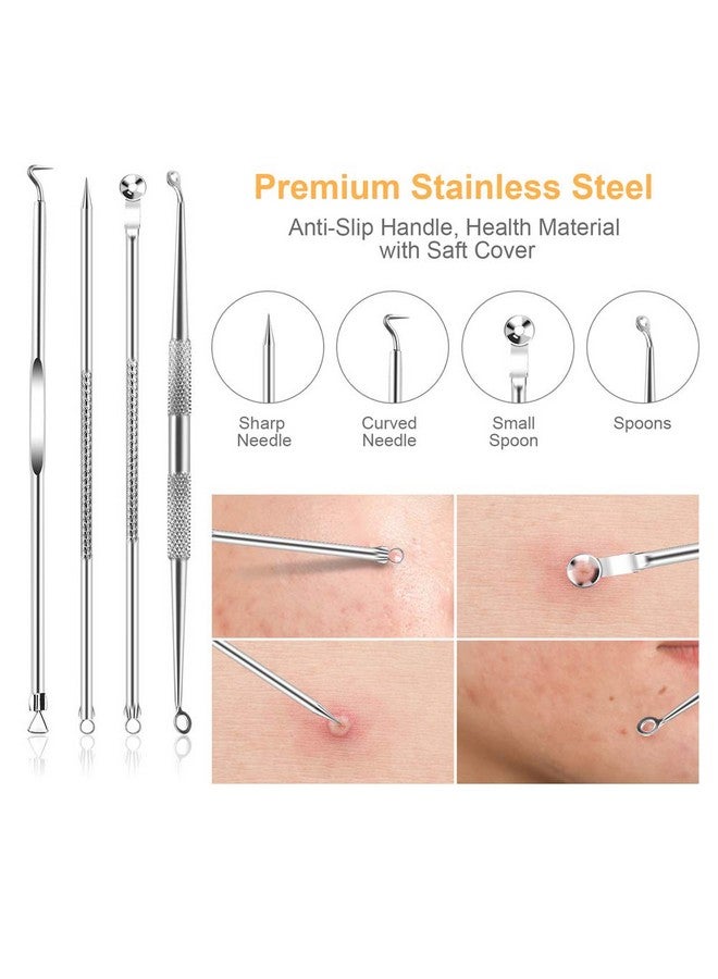 Pimple Popper Tool Kit Uubaar 9 Pcs Blackhead Remover Tools With Tweezers 16Heads Professional Acne Zit Pimple Popper Extraction Tools Whitehead Comedone Extractor Kit For Facial Nose