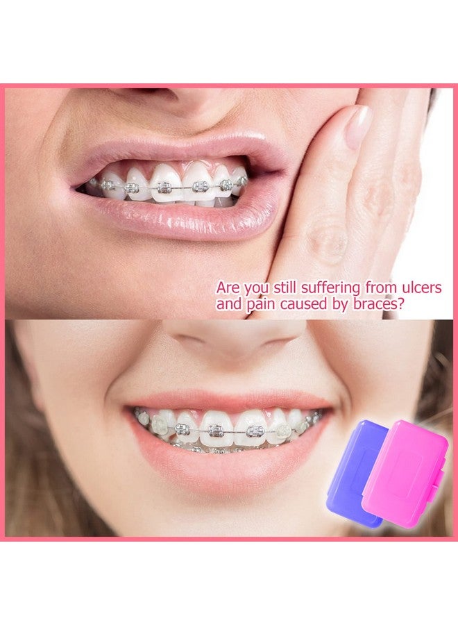 Braces Wax Dental Wax For Braces Moldable Orthodontic Wax For Retainerbrace Wearers Food Grade Material (6 Packs)