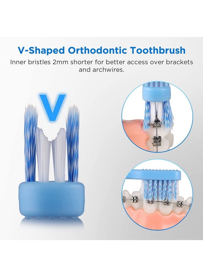 Vshaped Orthodontic Toothbrush For Braces Soft Bristles 6 Count