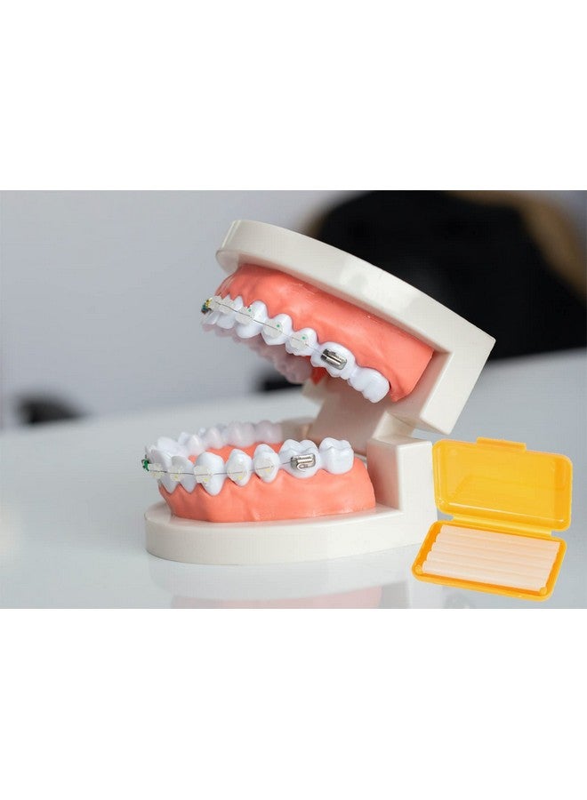 15 Pack Colorful Braces Wax Dental Care Orthodontic Wax For Braces Wearer (10 Color)