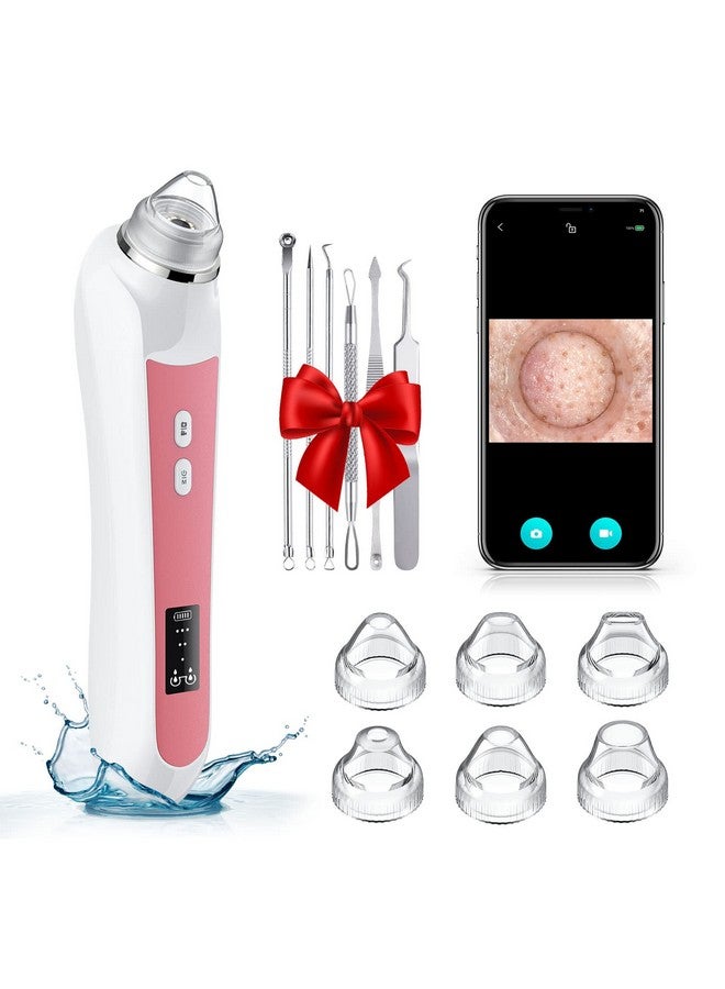 Blackhead Remover Vacuum Usb Interface Type Pore Vacuum Black Head Extractions Tool With Camerafor Men And Women Pore Cleaner 3 Adjustment Modes & 6 Suction Heads(Light Pink)