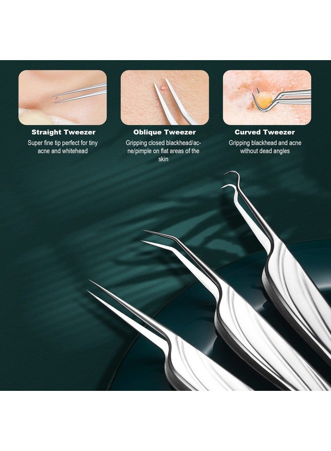 Blackhead And Acne Extractor Kit Professional Pimple Popper Tool Kit Acne Tweezers And Blackhead Remover Tools For Face 6 Pcs Surgical Extractor Pimple Popping Tools