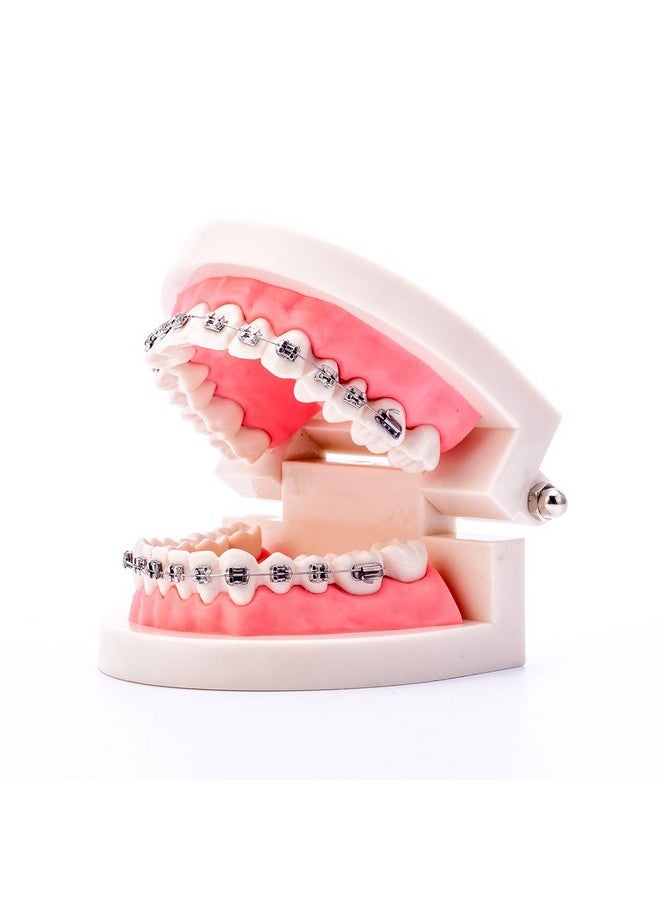 Dental Orthodontic Model Teeth Model With Metal Bracket Tooth Model With Brace For Patients Communication