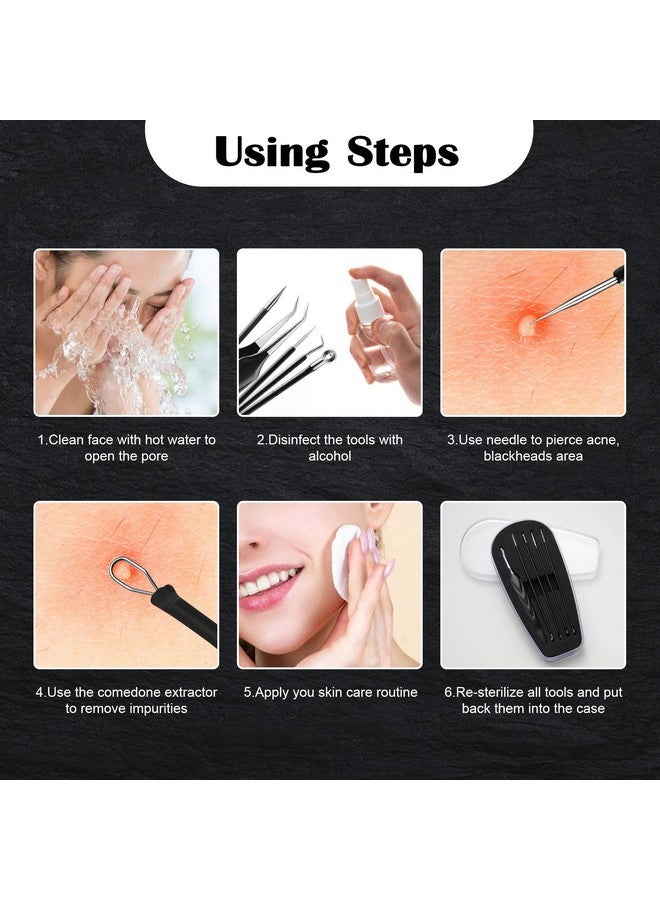 Blackhead And Acne Extractor Kit Professional Pimple Popper Tool Kit Acne Tweezers And Blackhead Remover Tools For Face 5 Pcs Surgical Extractor Pimple Popping Tools