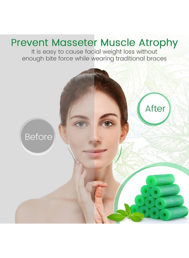 Aligner Chewies For Invisalign Aligners Mint Scented (20 Pcs Green) And 2 Aligner Removal Tools