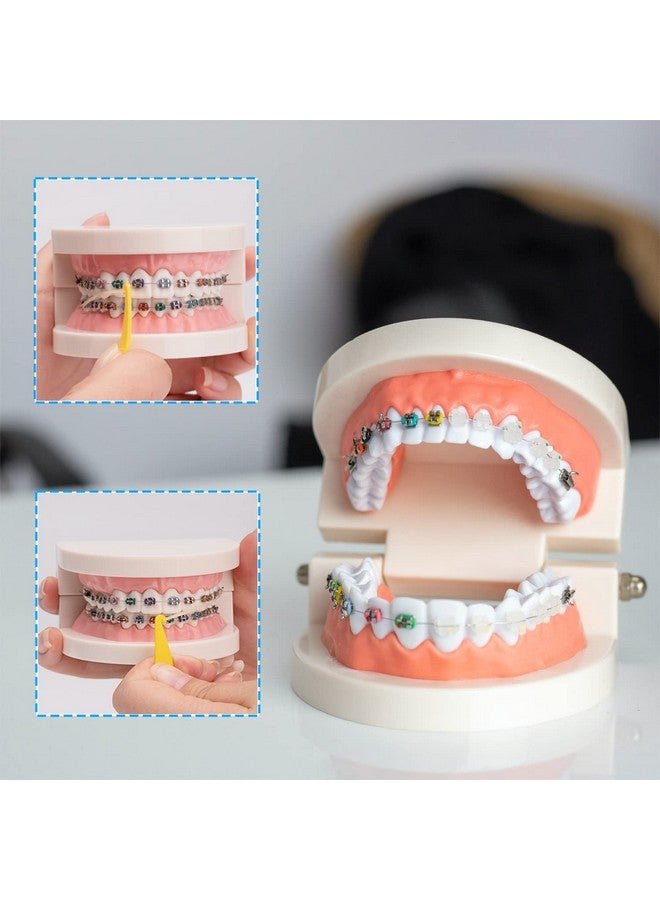 100 Pcs Colorful Disposable Plastic Braces Elastic Rubber Bands Placers Tool For Braces Dental Orthodontic