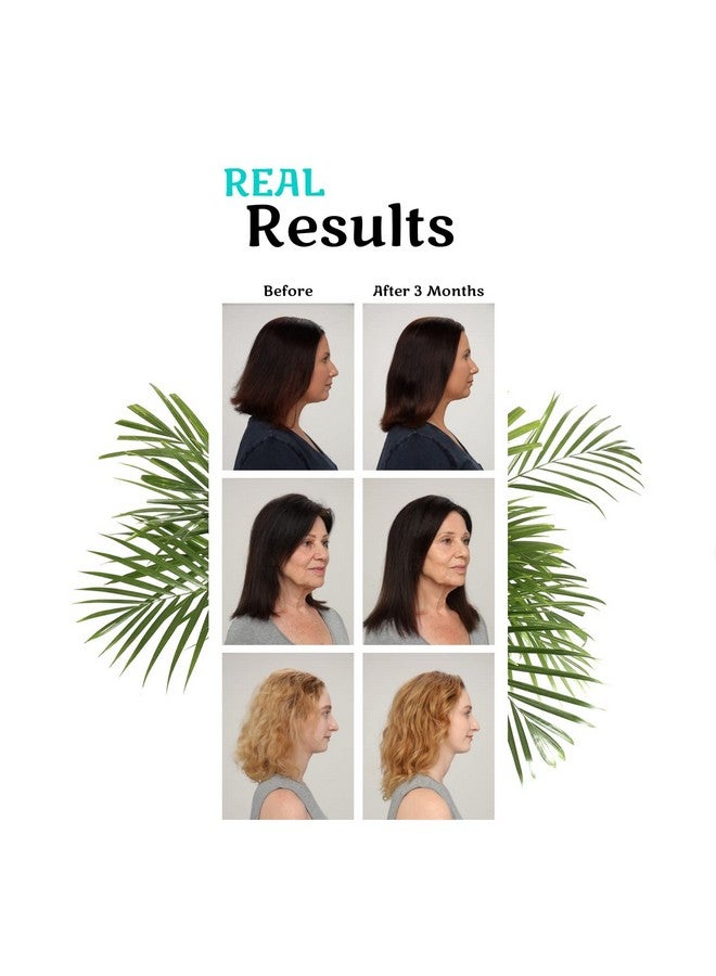 Clinical Formula Hair Growth Vitamins For Women And Men With Biotin 5000Mcg Collagen And Saw Palmetto Healthy Hair Growth Supplement Within Normal Ranges 90 Count (Pack Of 1)