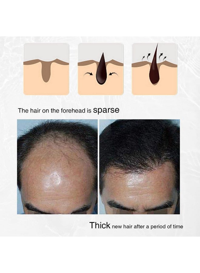 Hair Growth Spray Onion Oil For Hair Growth Organic Hair Growth Serum Enriched With Rosemary Black Seed Oil Control Hair Loss Promotes Hair Growth