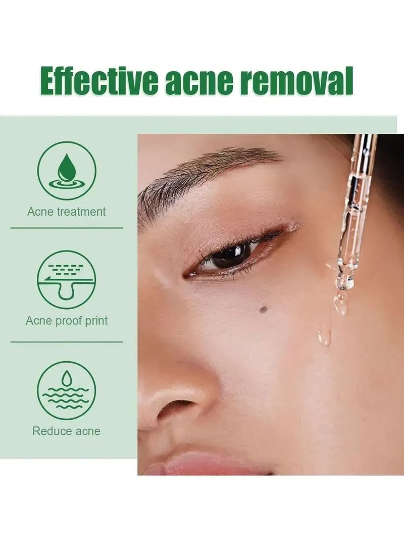 Acne Treatment Serum, Anti Ageing Pore Shrinking Skin Care Essence, Facial Repair Moisturizing Essence, Pimple Spots Remover Tea Tree Serum For Dark Spots Acne Pimples, Green