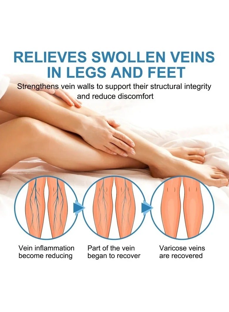 Varicose Veins Treatment Spray, 30ml Vasculitis Phlebitis Relief Cream, Healing Varicose Vein Spray For Legs, Improve Blood Circulation, Soothes Tired Legs, (30ml)