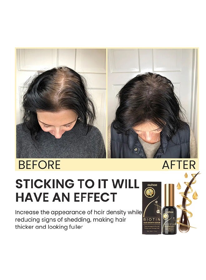 Biotin Hair Growth Serum 30ml,Can Promote Hair Growth,Hair Repair,Strong And Fragile Hair,Suitable For All Hair Types