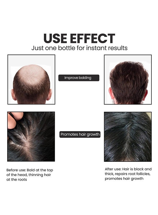 Biotin Hair Growth Serum 30ml,Can Promote Hair Growth,Hair Repair,Strong And Fragile Hair,Suitable For All Hair Types