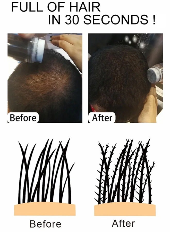 Hair Building Fibers- 5 Seconds Cover Hair Loss , Keratin Thicker Anti Hairs Loss Concealer Thickening Fiber Powders Growth , Conceals Hair Loss And Look Younger