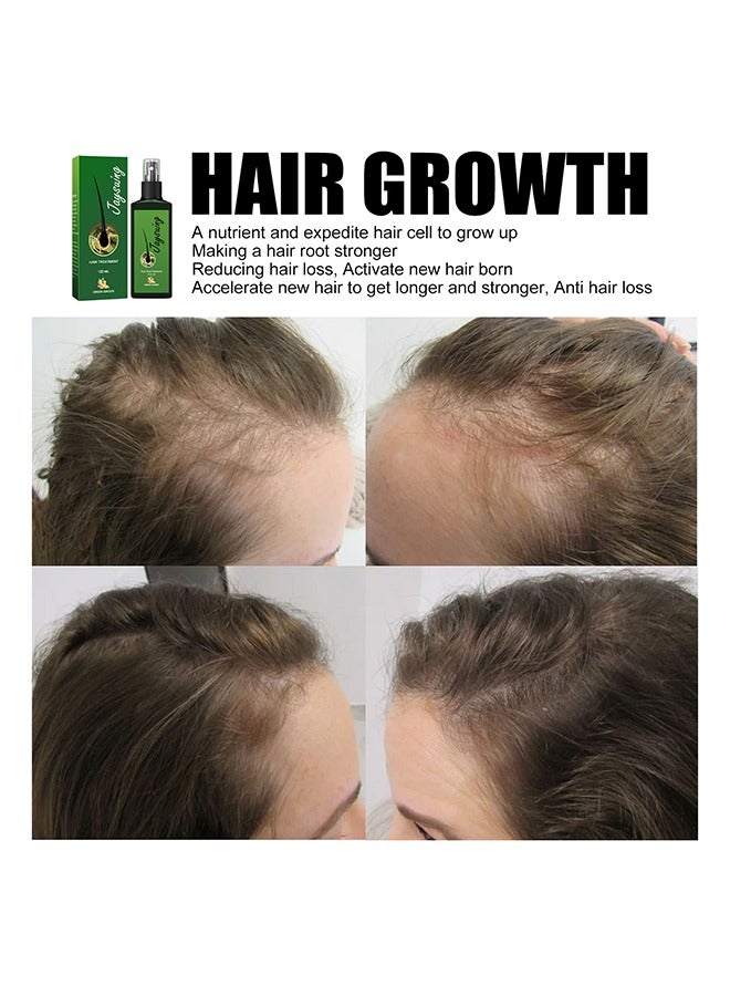 Hair Treatment Green Ginger Serum Hair Lotion ,Hair Loss Treatments, Aids against Hair-thining, Hair Regrowth Treatment-120ML