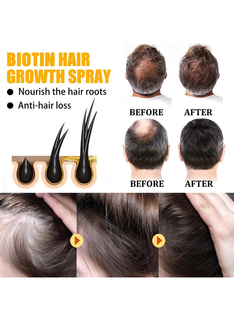 Hair Growth Spray, Biotin Thickening Herbal Serum, Anti-hair Loss Hair Care Oil, Fast Hair Growth Biotin Herbal Serum For Thicker Longer And Stronger Hair, (1pc 30ml)