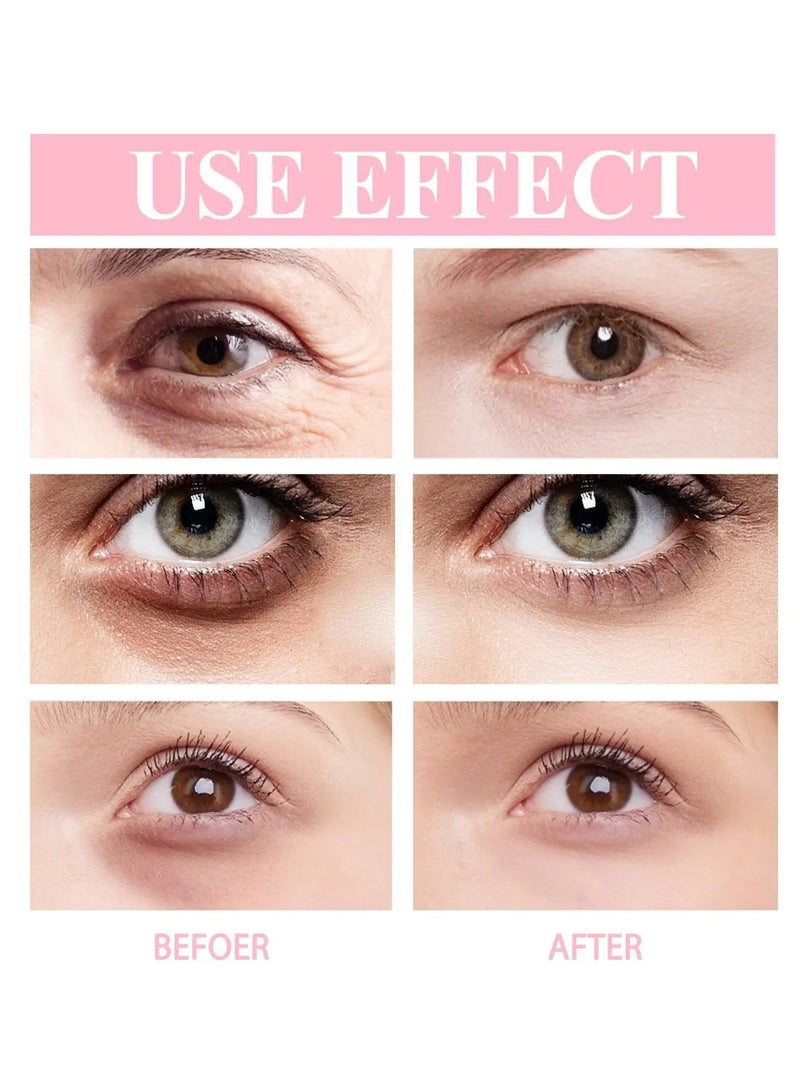 Eye Cream, Eye Stick for Dark Circles and Puffy Eyes, Hydrating and Brightening Anti-wrinkle Eye Cream Stick, Eye Cream to Reduce Wrinkles and Fine Lines
