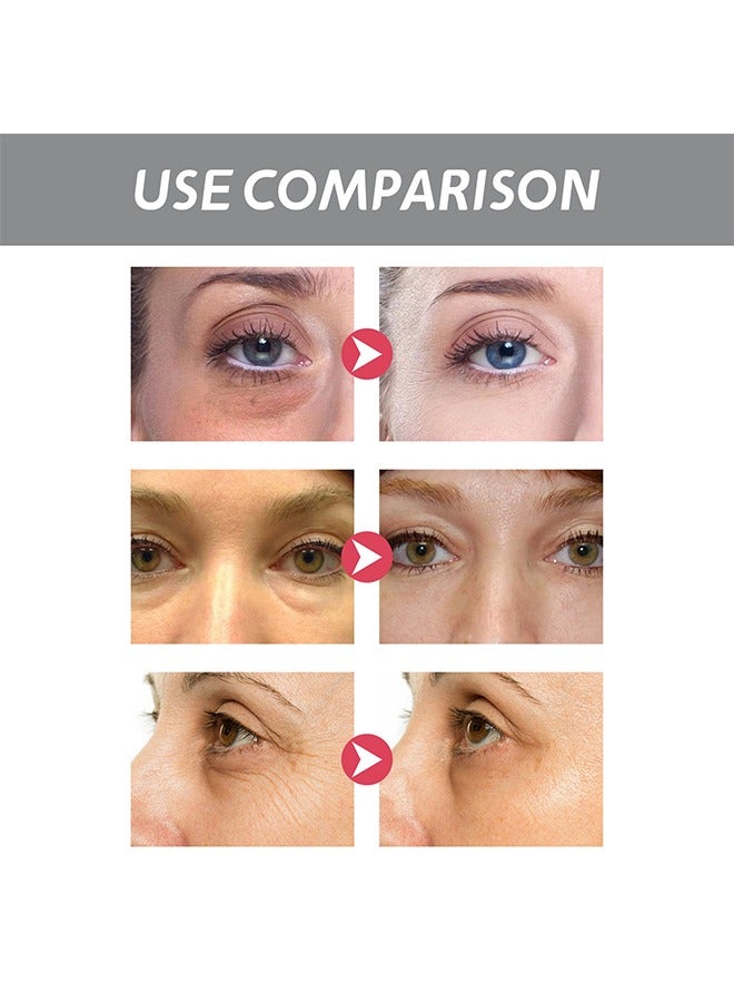 Retinols Eye Cream , Anti Aging Eye Cream with Hyaluronic Acid and Collagen, Under Eye Cream Dark Circles and Puffiness