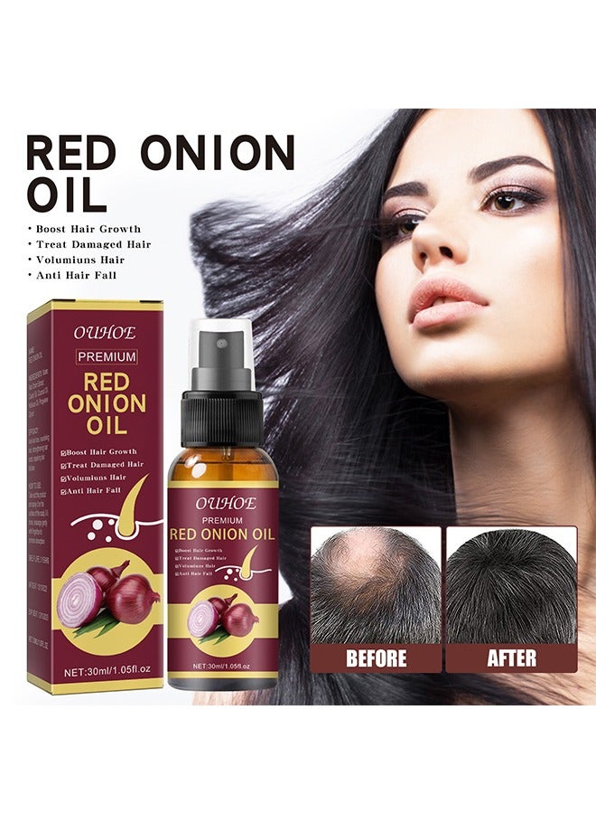 Red onion Oil，Onion Hair Oil Rapid Growth Hair Treatment 7 Day Hair Growth Serum Essence Oil Regrow,  Stop Hair Loss Hair, Thinning Treatment Hair Growth Oil for Women & Men 30ML