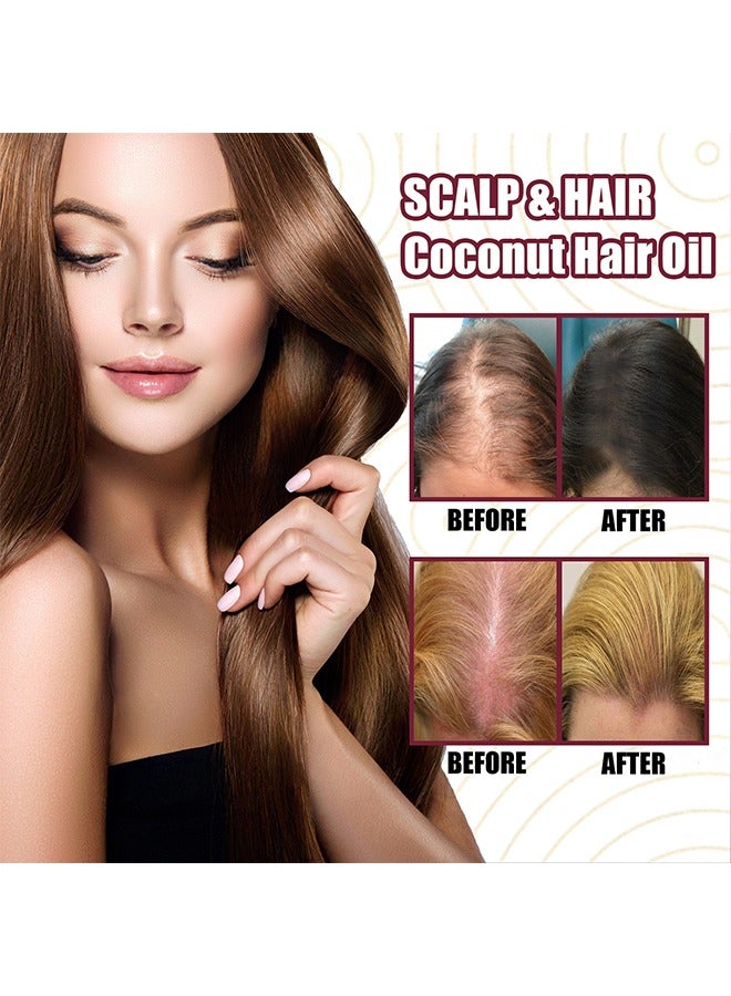 Red onion Oil，Onion Hair Oil Rapid Growth Hair Treatment 7 Day Hair Growth Serum Essence Oil Regrow,  Stop Hair Loss Hair, Thinning Treatment Hair Growth Oil for Women & Men 30ML