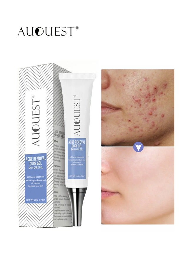 Acne Remoyal Gure Gel -Herbal Acne Treatment Cream Pimple Spot Removal for Teens Oil Control Acne Scar Gel Shrink Pores Skin Care Beauty Health 20g