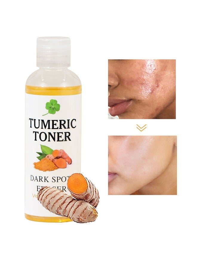 Turmeric Dark Spot Corrector Toner 100ML Facial Toner For Acne Prone Skin Dark Spot Remover For Face Hydrating Face Toner For Women Treatment 100ml