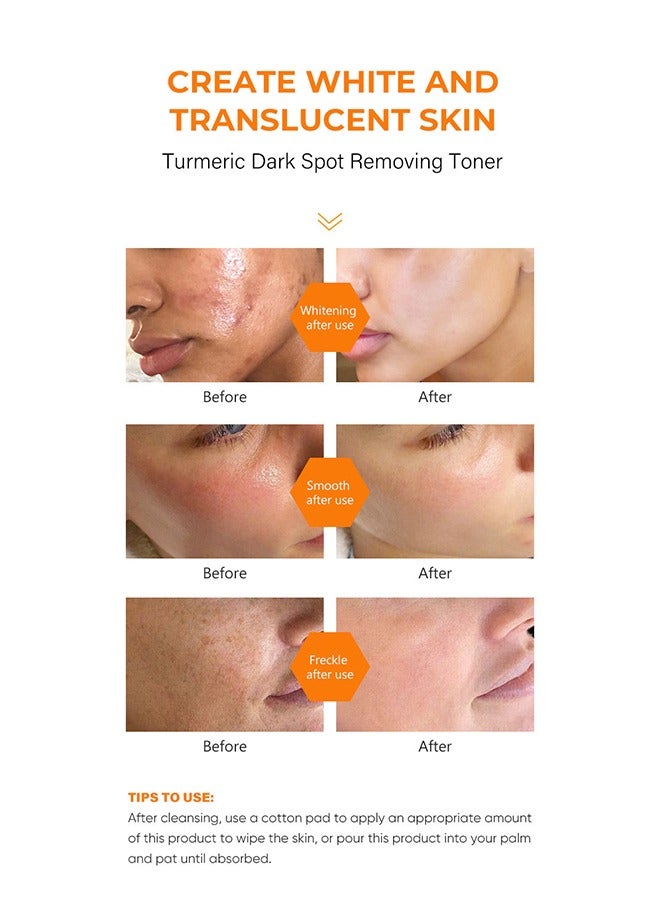 Turmeric Dark Spot Corrector Toner 100ML Facial Toner For Acne Prone Skin Dark Spot Remover For Face Hydrating Face Toner For Women Treatment 100ml