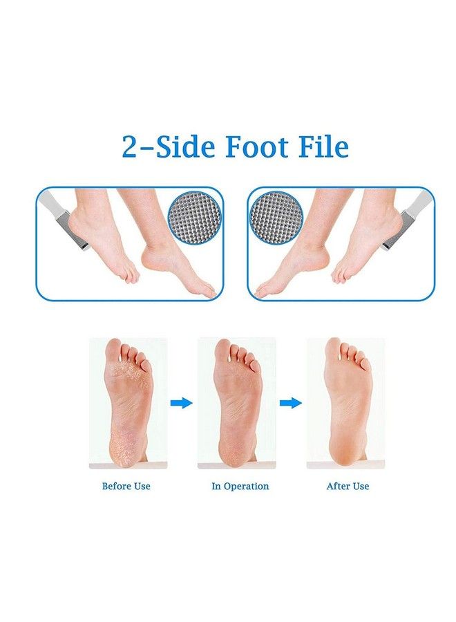 Foot Scrubber For Remove Dead Skin Pack Of 1 (White Stone)