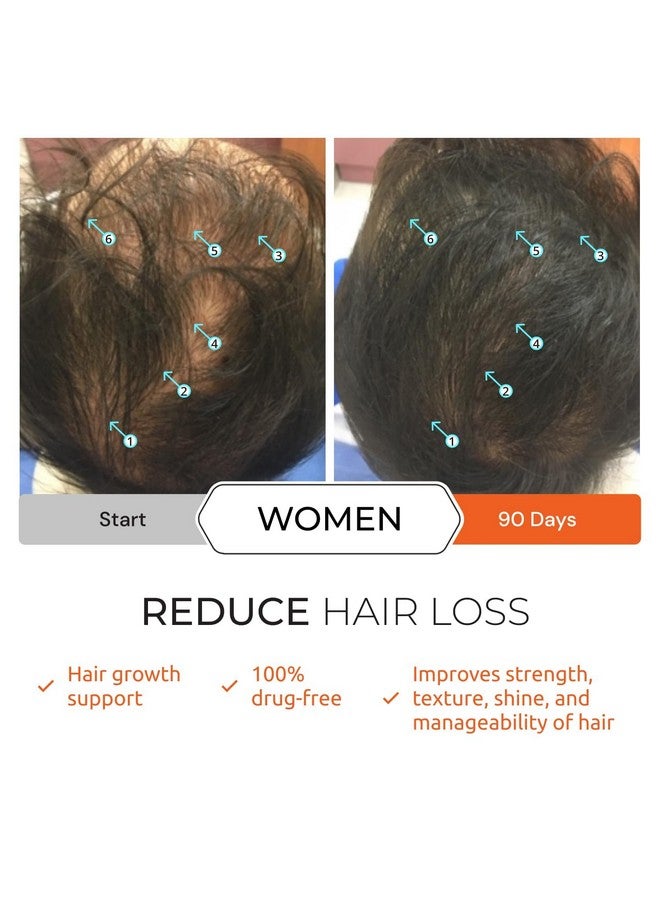 Revita Tablets Hair Supplement For Hair Growth Support Zinc Iron Magnesium Melatonin Vitamin D & Biotin Vitamins For Women & Men Hair Vitamins For Thicker Hair Growth Hair Care