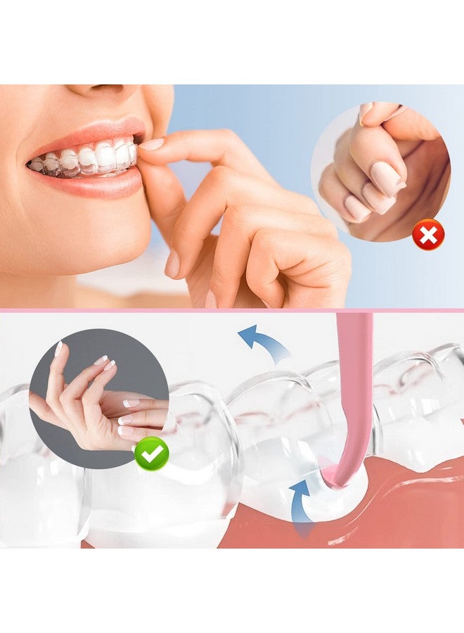 Aligner Removal Tool 2 Retainer Remover Tool Invisible Braces Removal Tools Suitable For Removing Braces Trays Retainers Dentures And Aligners(Blue+Pink).