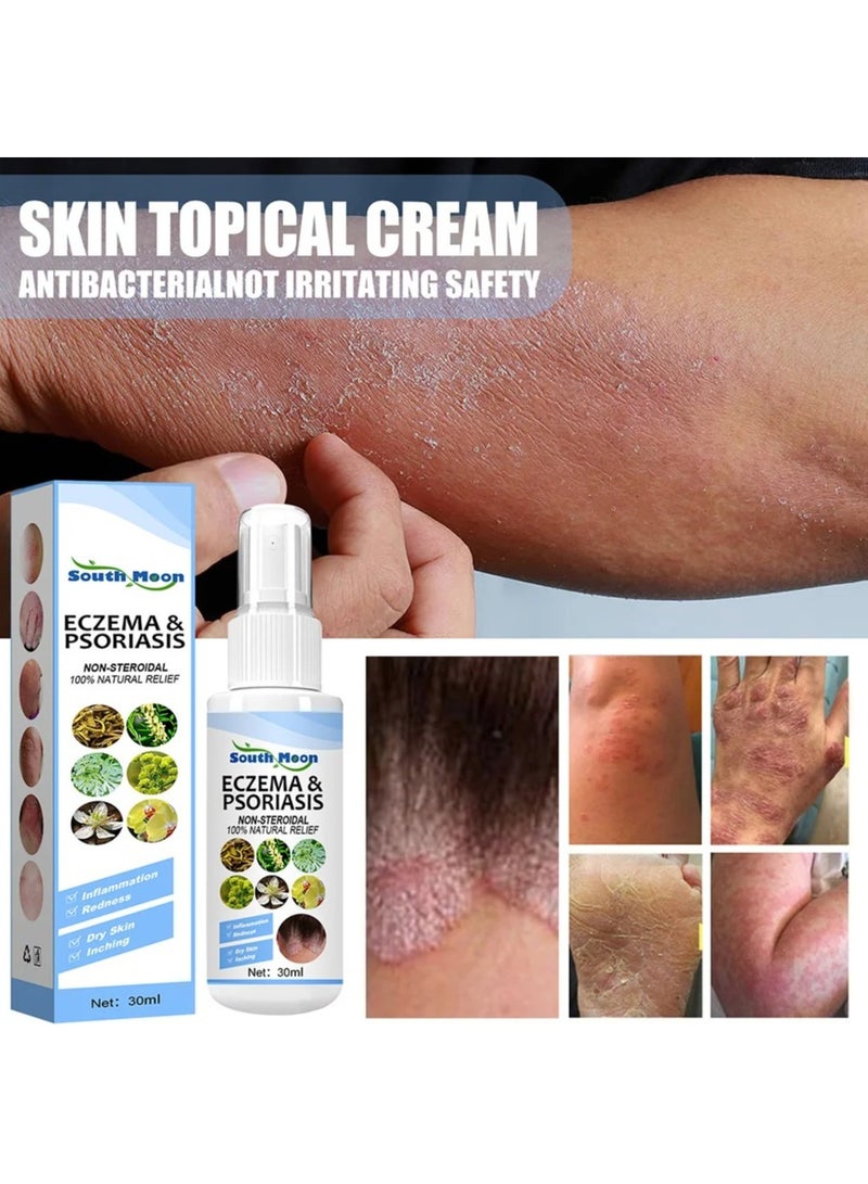 Herbal Psoriasis Relief Spray, Safe And Effective Eczema Soothing Spray, Simple And Convenient Herbal Psoriasis Soothing Mist, Quick Application Vitiligo Removal Relief For All Skin Types