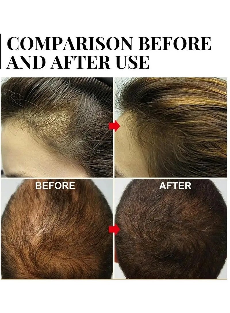 Batana Oil For Hair Growth, Natural And Safe Nourishing Hair Care Oil,  Moisturizing Batana Oil Butter For Hair Loss Treatments, Organic Hair Growth Essence For All Hair Types, ( A 30ml)