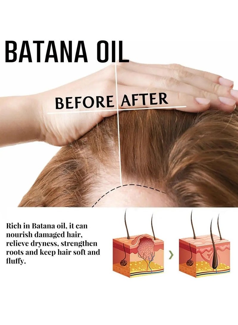 Batana Oil For Hair Growth, Natural And Safe Nourishing Hair Care Oil,  Moisturizing Batana Oil Butter For Hair Loss Treatments, Organic Hair Growth Essence For All Hair Types, (B 20ml)