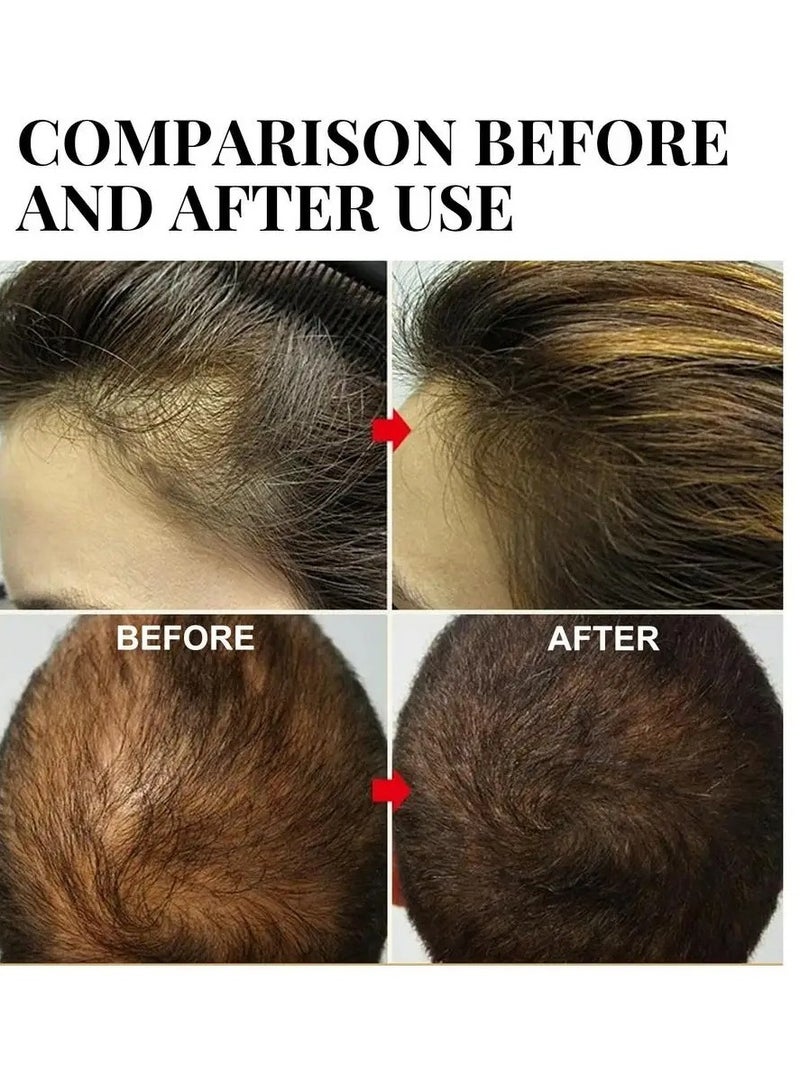 Batana Oil For Hair Growth, Natural And Safe Nourishing Hair Care Oil,  Moisturizing Batana Oil Butter For Hair Loss Treatments, Organic Hair Growth Essence For All Hair Types, (C 30ml)