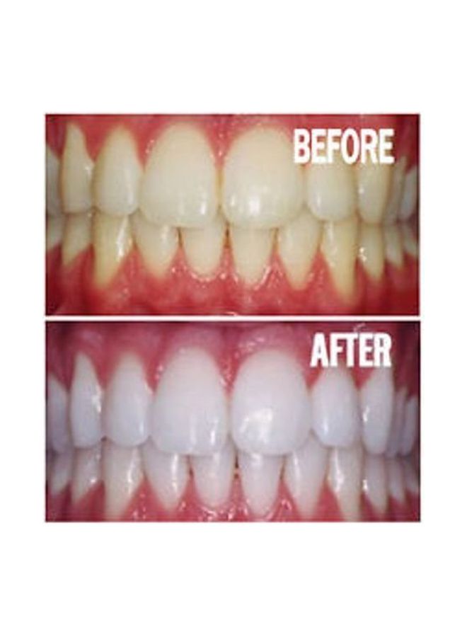 Advance Teeth Whitening White