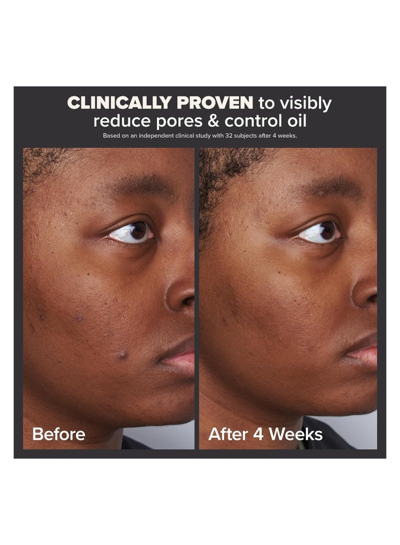 Paulas Choice SKIN PERFECTING 2% BHA Liquid Salicylic Acid Exfoliant--Facial Exfoliant for Blackheads, Enlarged Pores, Wrinkles & Fine Lines - 118ml