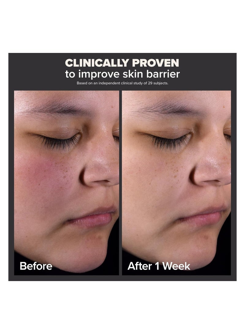 Paulas Choice SKIN PERFECTING 2% BHA Liquid Salicylic Acid Exfoliant--Facial Exfoliant for Blackheads, Enlarged Pores, Wrinkles & Fine Lines - 118ml