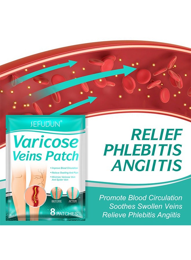 Varicose Veins Patch, Varicose Veins Treatment For Legs, Spider Varicose Vein, Strengthen Capillary Health and Improve Blood Circulation, Improves Blood Circulation, Relieves Leg Fatigue 16 PCS