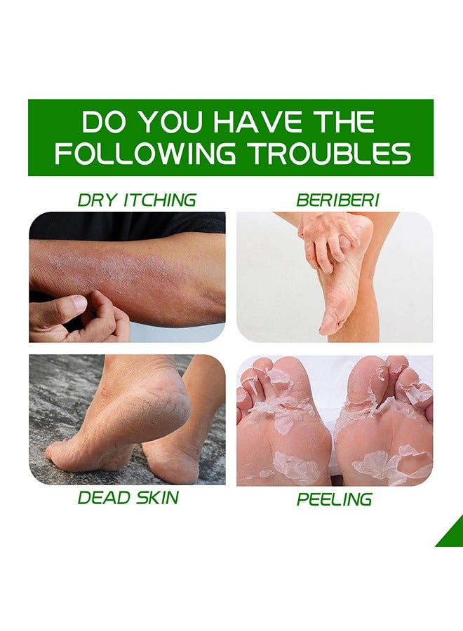 Allantoin 40% Cream100g,Foot Care Cream For Cracked,Rough Thick and Dry Skin Soothes and Softens Feet,Elbows and Knees Hydrating and Moisturizing Foot Care Cream