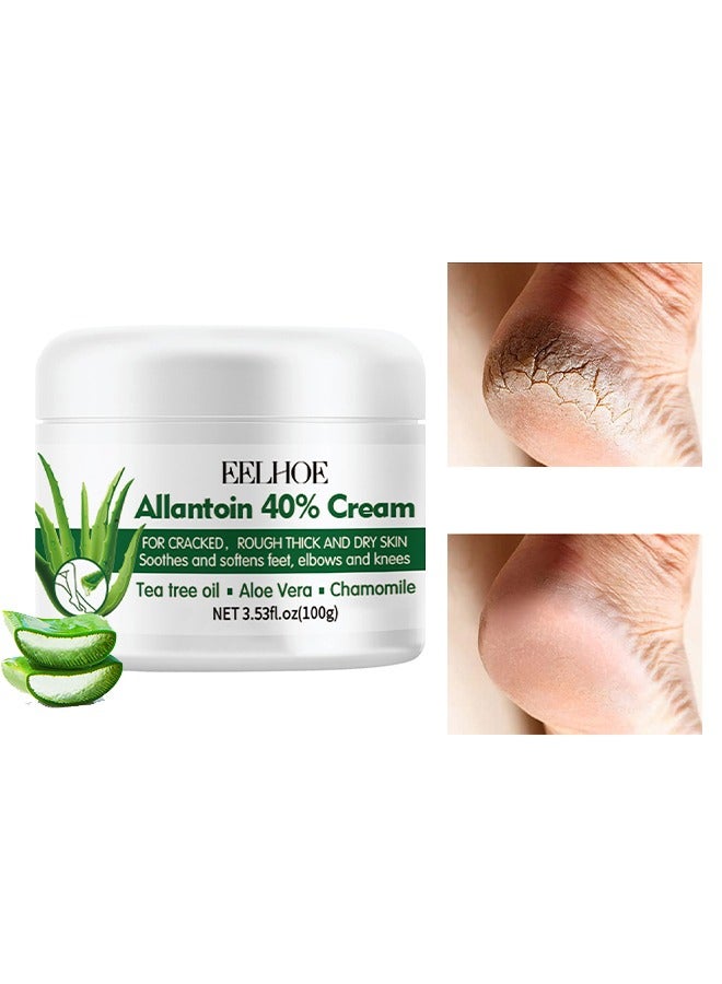 Allantoin 40% Cream100g,Foot Care Cream For Cracked,Rough Thick and Dry Skin Soothes and Softens Feet,Elbows and Knees Hydrating and Moisturizing Foot Care Cream