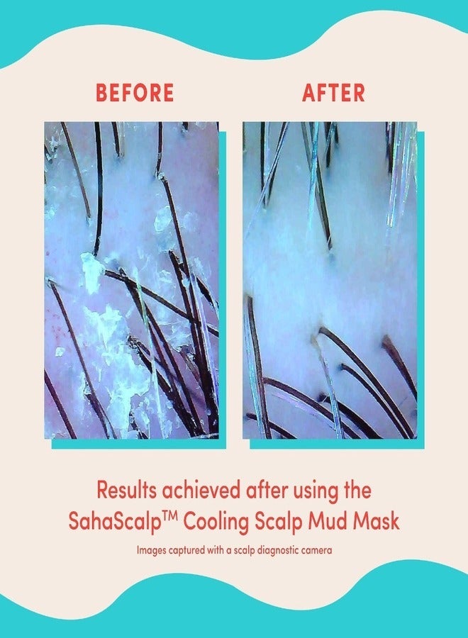 Fable and Mane SahaScalp™ - Scalp Reset Kit