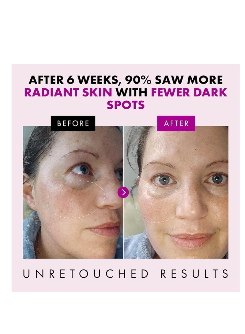 Collagen Anti Aging Face Cream with Patented Matrixyl-3000 & Argireline - 5x More Powerful w/ Pep-Boost Peptide Complex + 10 Antioxidants - Facial Wrinkle Day/Night Cream Face Moisturizer for Women