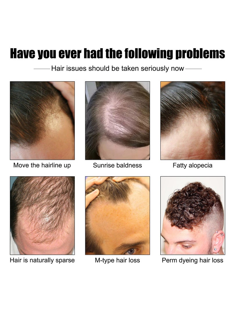 Men's Thick Hair Serum, Hair Growth Serum For Thinning Hair For Men, Anti Hair Loss Regrowth Essence Oil For Moisturizing, Anti-hair Loss, Thick And Solid Hair