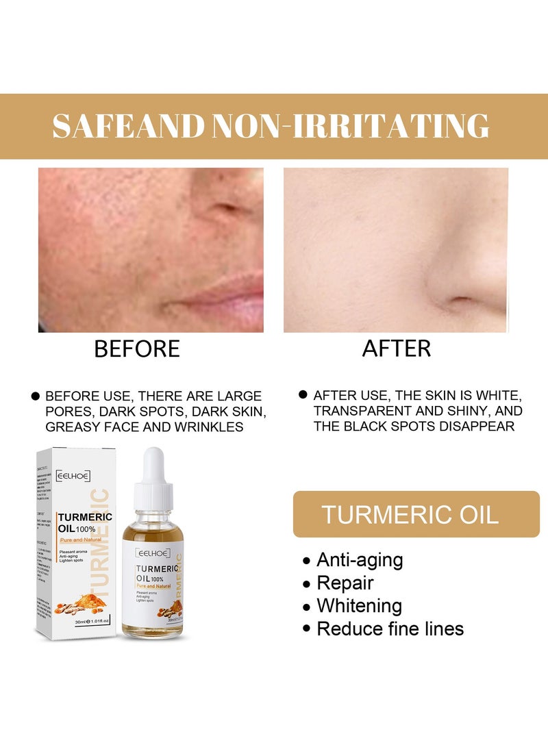 Turmeric Dark Spot Corrector Serum, 30ml Skin Care Moisturizing Repair Serum, Moisturizing And  Brightening Turmeric Oil For Acne, Dark Spots, Hyperpigmentation, Smooth Skin