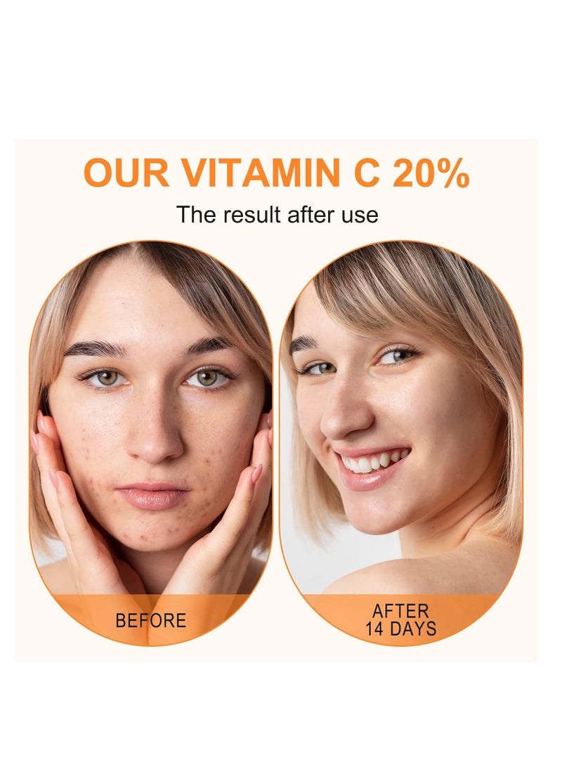 Premium 20% Vitamin C Serum For Face with Hyaluronic Acid, Retinol & Amino Acids - Boost Skin Collagen,Hydrate & Plump Skin, Anti Aging & Wrinkle Facial Serum 60ml