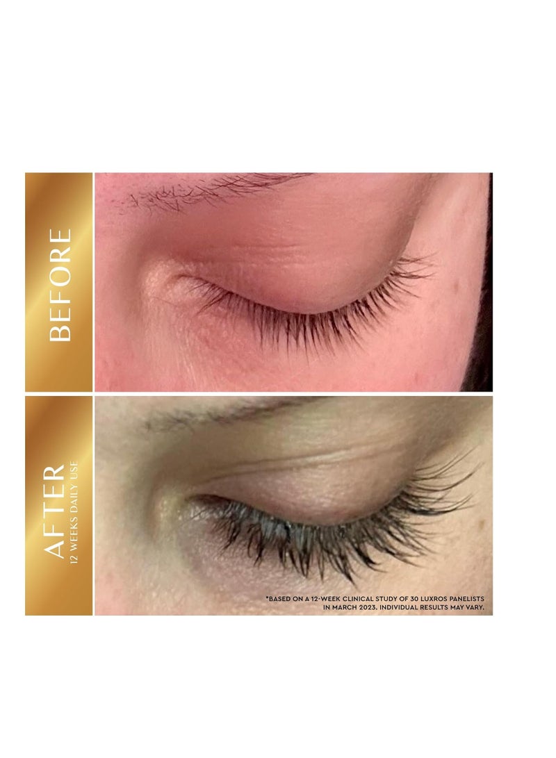 Eyelash Growth Serum 5 mL: Get Thick, Strong Lashes in Just 3-4 Weeks with Our Plant-Based Eyelash Growth Serum - No Parabens - Made in USA