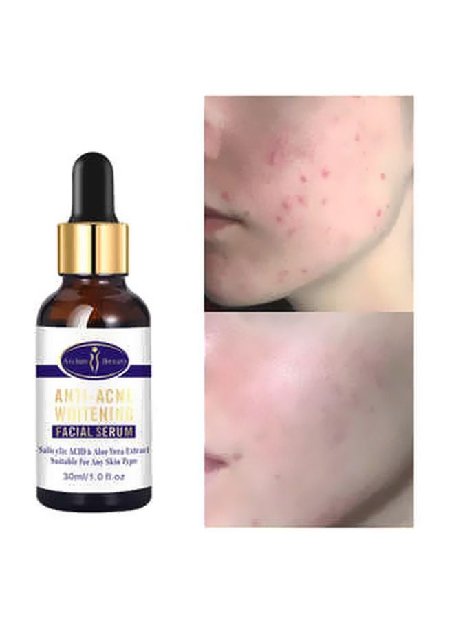 Anti Acne Whitening Facial Serum 30ml