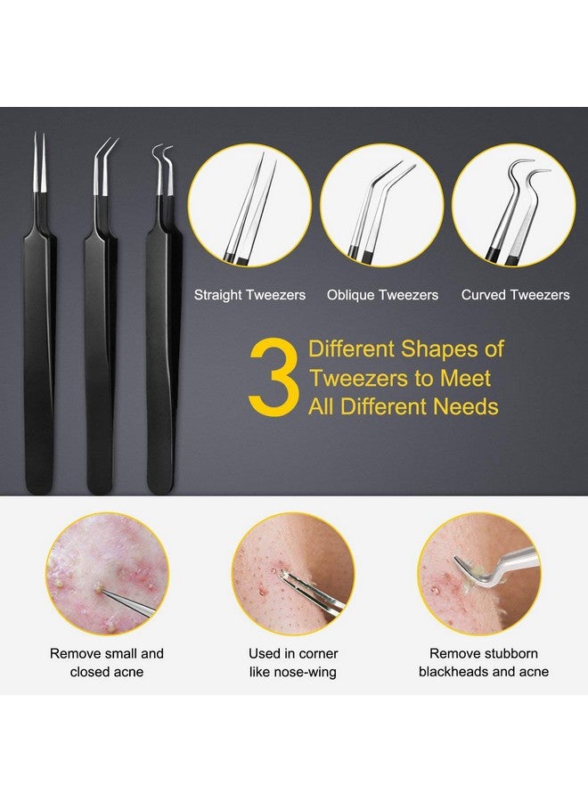 Pimple Popper Tool Kit Boxoyx 10 Pcs Blackhead Remover Comedone Extractor Kit With Box For Quick And Easy Removal Of Pimples Blackheads Zit Removing Foreheadfacial And Nose (Black)