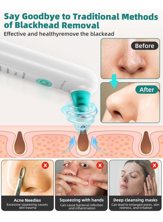 Blackhead Remover Vacuum Pore Vacuum With Nano Facial Mister Usb Rechargeable Blackhead Extractor For Removing Blackheads Acne Whiteheads Exfoliation4 Suction Heads & 5 Adjustment Modes